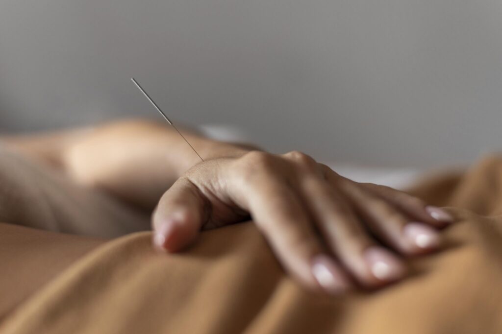 close-up-hand-with-acupuncture-needle-2048x1363